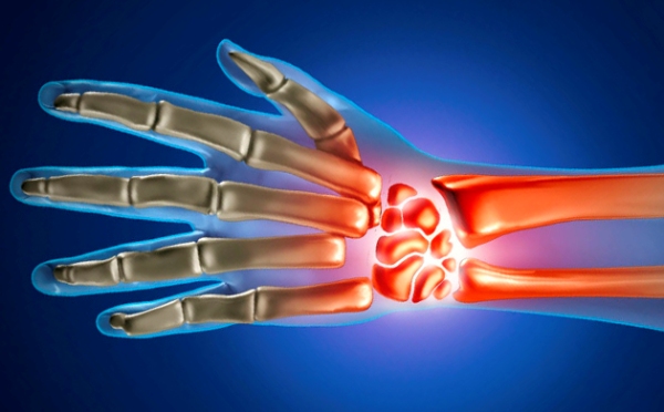 Harjade liigeste artroos ravi Fibromualgia valu liigestes