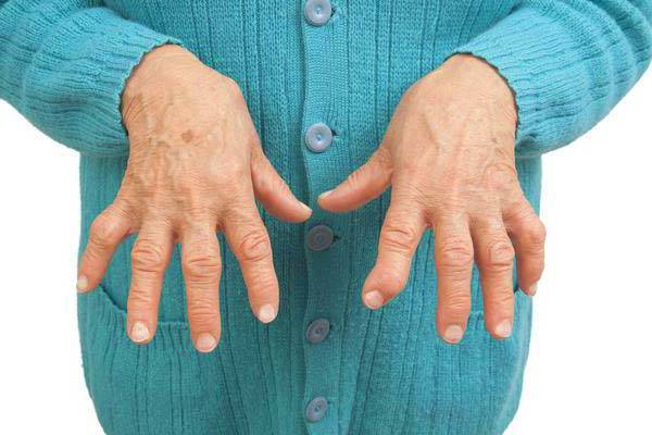 Ravi harjade artroosiga Laminaria liigeste valu