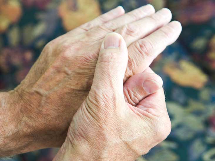 Rheumatoida artroosi Rahvavabariikide ravi
