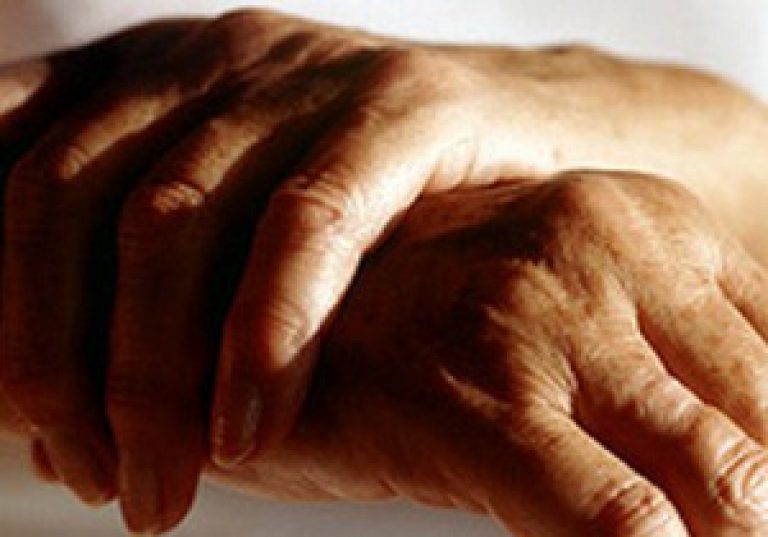 Kuidas eemaldada artriidi sormede koonused Juhtide ravi Chelyabinsk