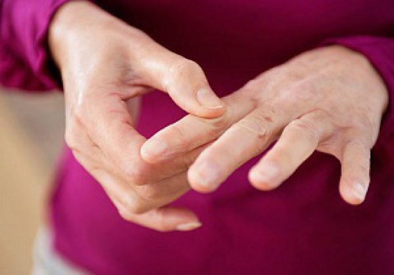 Mida teha artriidi sormedes