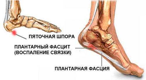 Valu jala salvi jalamil Osteokondroseoksiidi hinnad