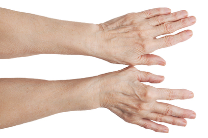 Kuidas eemaldada artriidi sormede koonused Laminaria liigeste valu