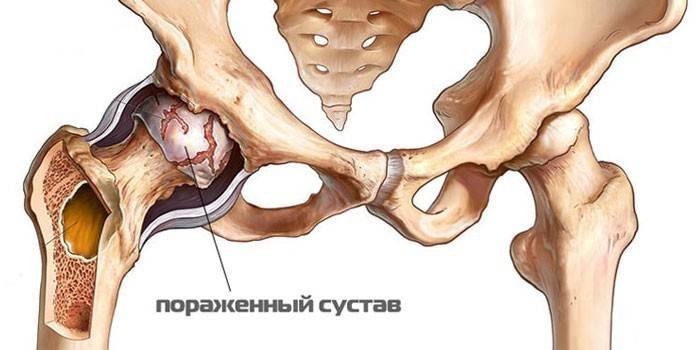 Pansion liigeste tootlemisega valutab sorme kate harja