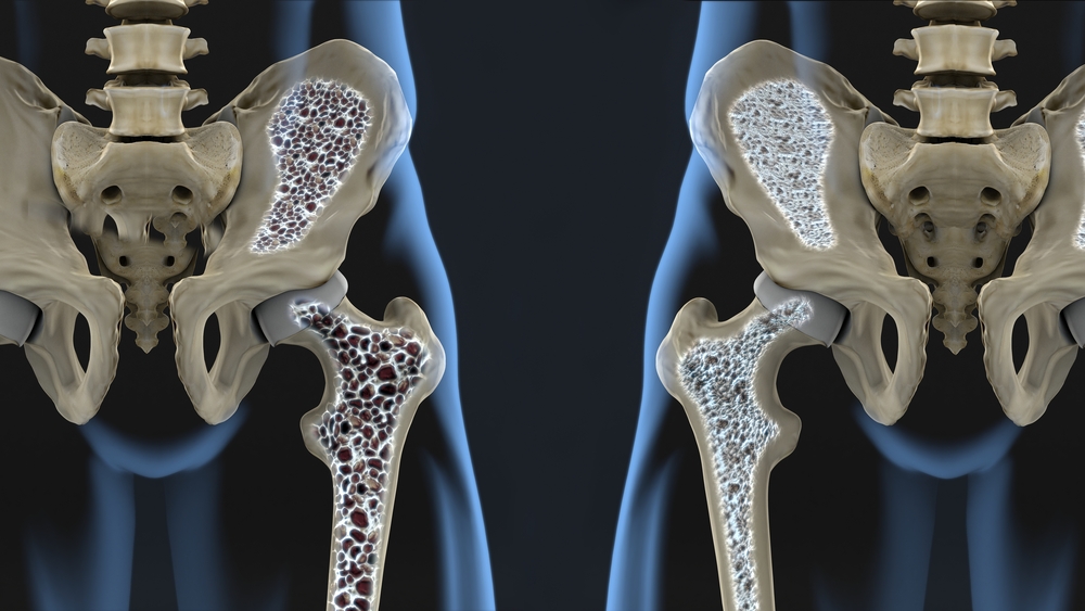 Mis liigese haigused voivad olla Mis on toodeldud artriidi jalad